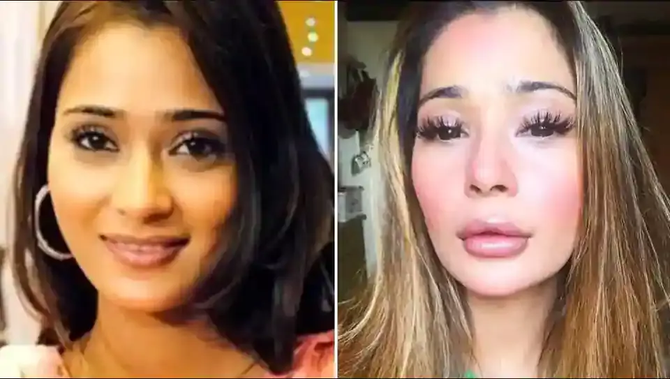 Sara Khan said that her lip filler did not suit her at all.